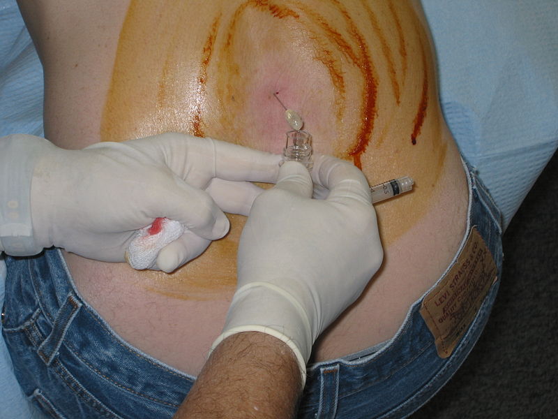 lumbar_puncture_test
