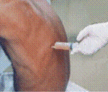 سائل الرئة 2