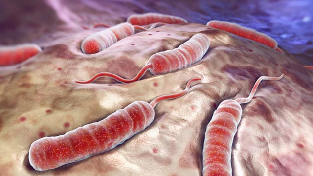 إدارة المخلفات الطبية في المراكز المؤقتة لعلاج الكوليرا