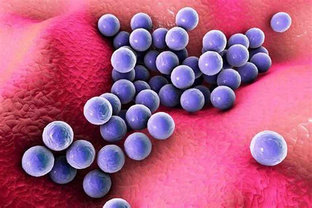 مخاطر وجود بكتيريا التهابات الجلد (Staphylococcus aureus) في نفايات الرعاية الصحية