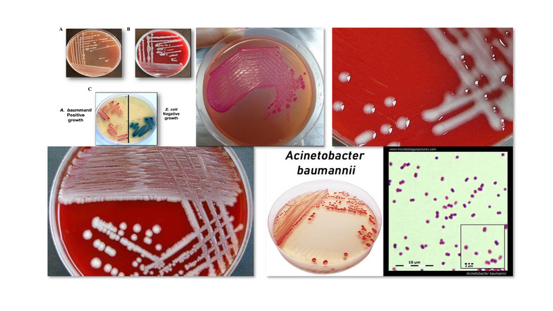 Acinetobacter baumannii