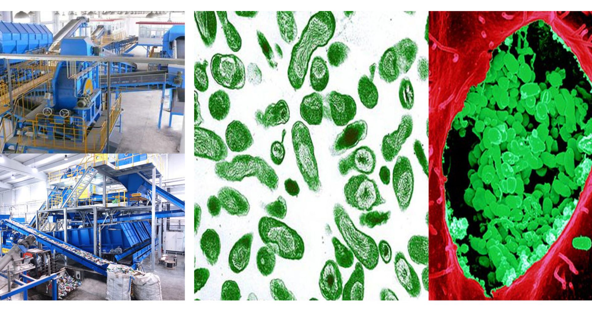 تفشي حمى كيو في العاملين بمحطة فرز ومعالجة النفايات البيولوجية في أسبانيا 1 تفشي حمى كيو في العاملين بمحطة فرز ومعالجة النفايات البيولوجية في أسبانيا