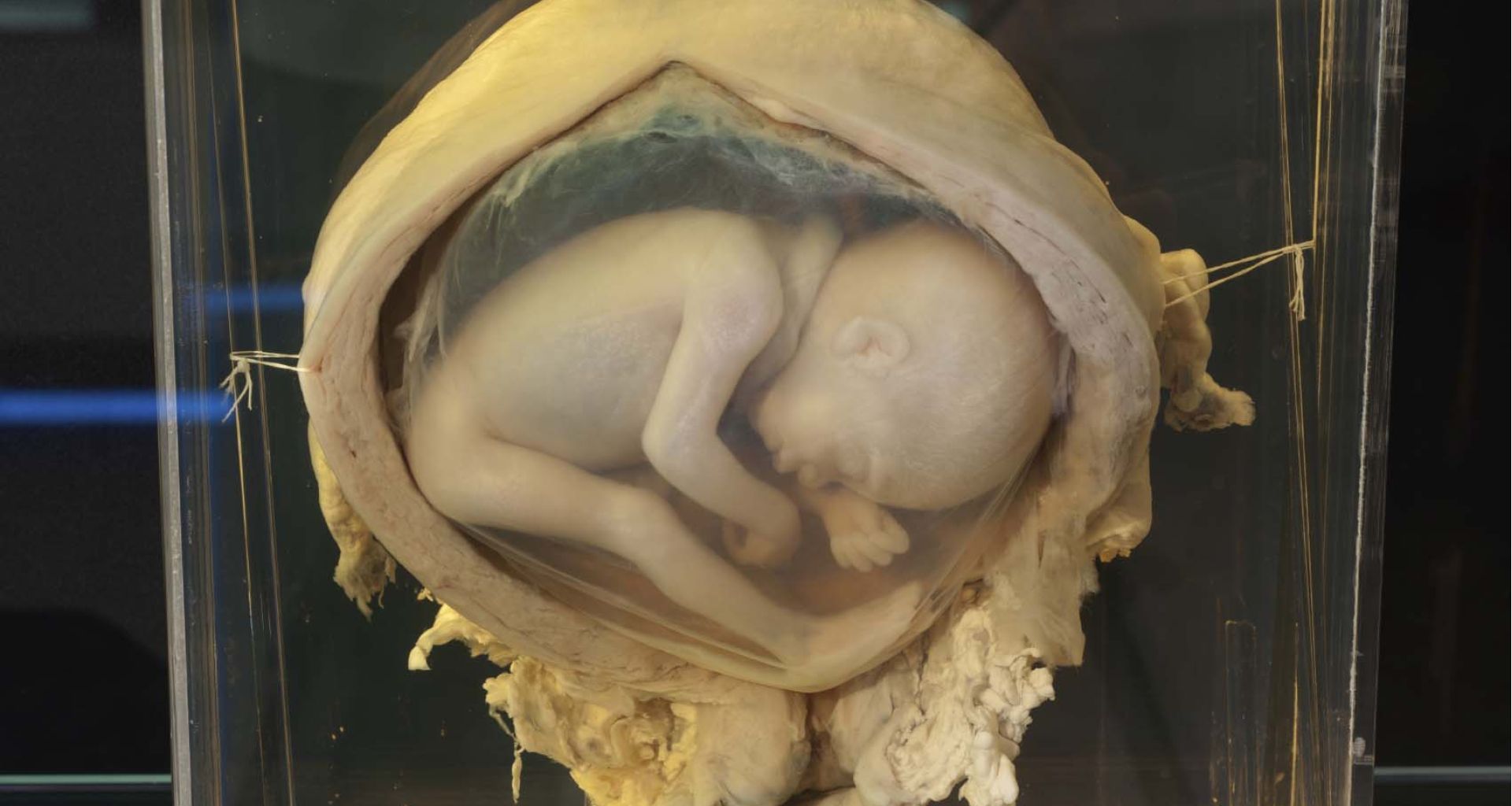 النفايات الطبية في مختبرات الهستوباثولوجي 1 النفايات الطبية في مختبرات الهستوباثولوجي