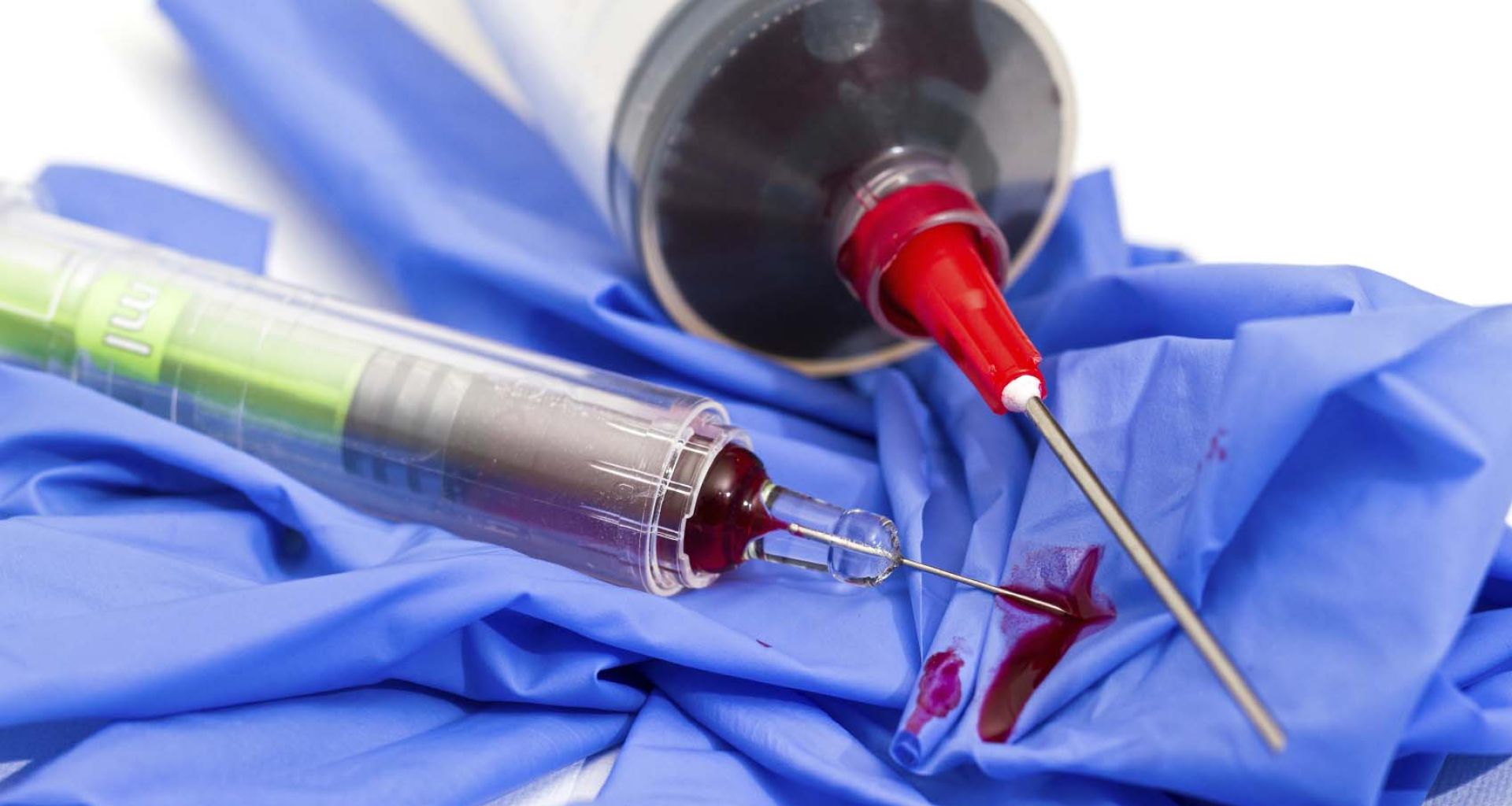 دراسة عن حوادث وخز الإبر والمواد الحادة في طلاب كلية الطب البشري بمدينة غريان- ليبيا. للباحثة نجاة العابد. 1 دراسة عن حوادث وخز الإبر والمواد الحادة في طلاب كلية الطب البشري بمدينة غريان- ليبيا. للباحثة نجاة العابد.