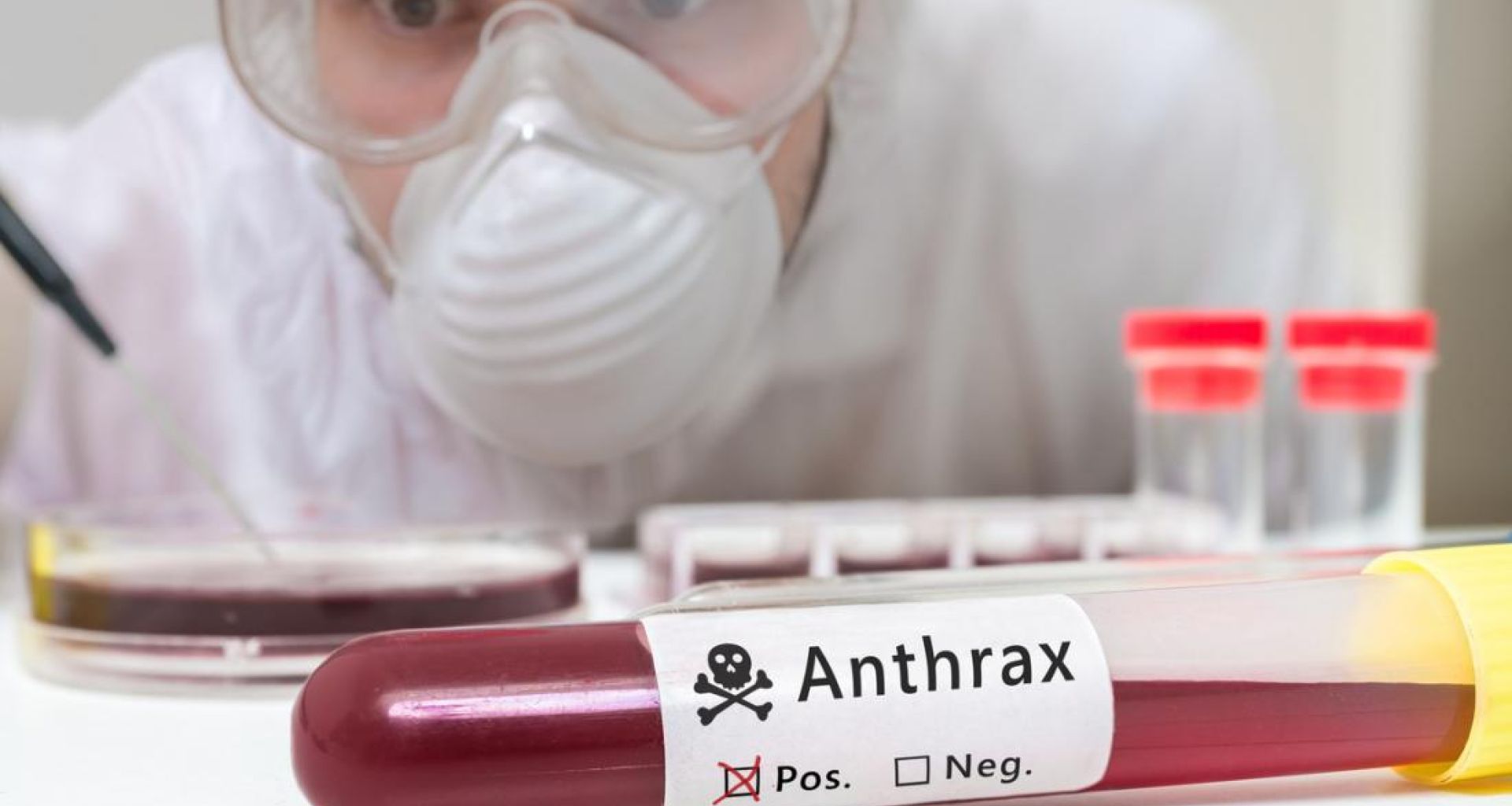 مرض الجمرة الخبيثة وإدارة النفايات الطبية 1 مرض الجمرة الخبيثة وإدارة النفايات الطبية