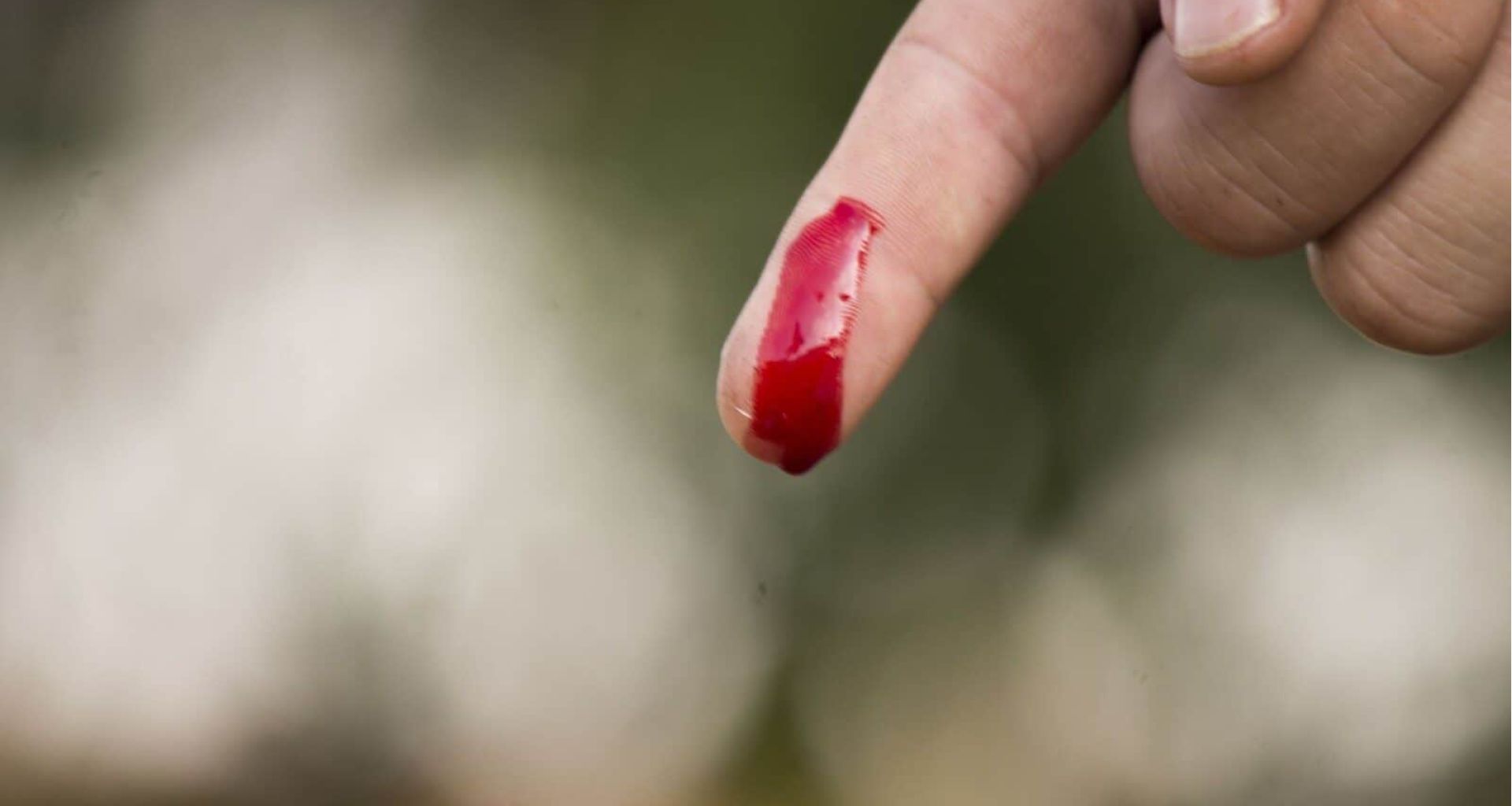 الإجراءات الواجب اتخاذها في حالة التعرض العرضي للدم في المستشفيات 1 الإجراءات الواجب اتخاذها في حالة التعرض العرضي للدم في المستشفيات