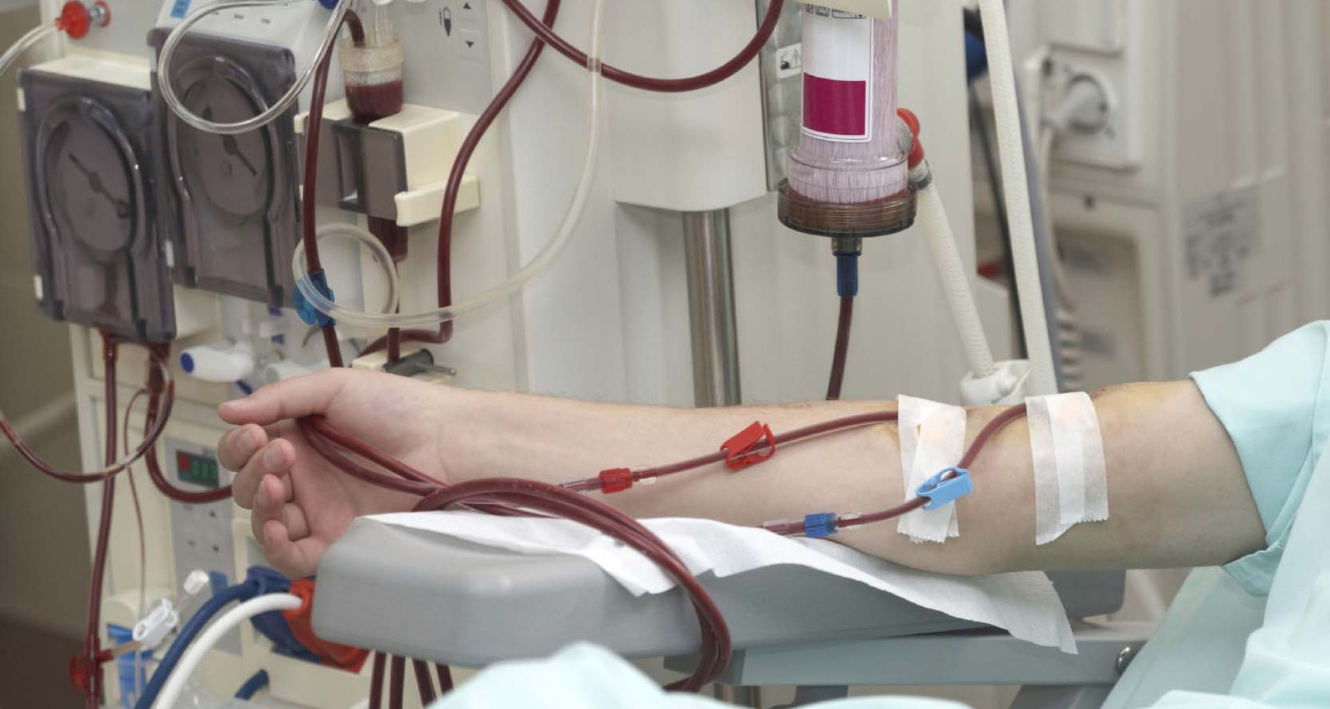 أنواع المخلفات الطبية لمراكز خدمات غسيل الكلى 1 أنواع المخلفات الطبية لمراكز خدمات غسيل الكلى