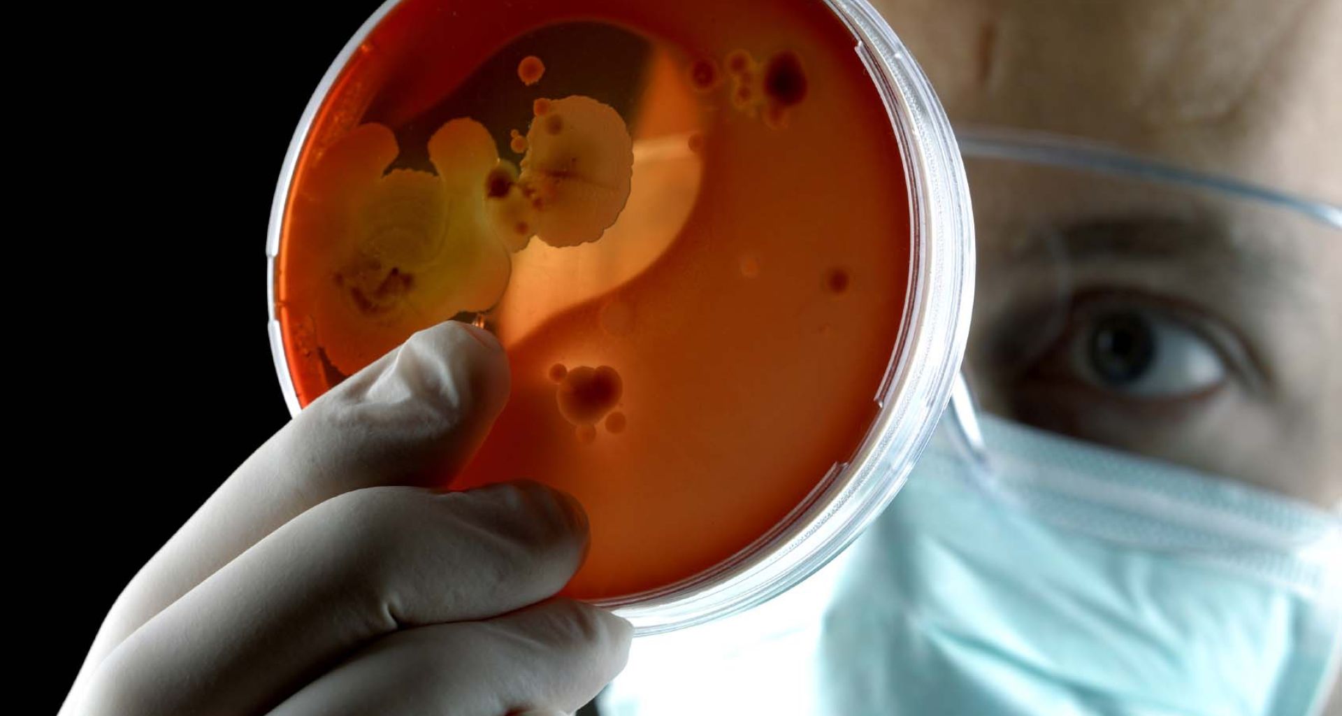 أجهزة الميكروويف لمعالجة النفايات الطبية الخطرة 3 أجهزة الميكروويف لمعالجة النفايات الطبية الخطرة