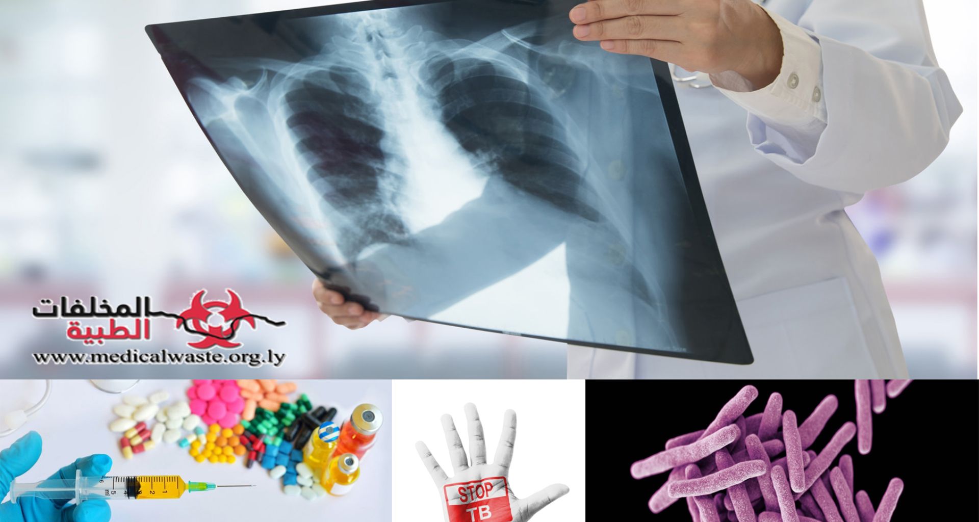 مراكز علاج السل: التحدي الكبير في إدارة المخلفات الطبية 6 مراكز علاج السل: التحدي الكبير في إدارة المخلفات الطبية