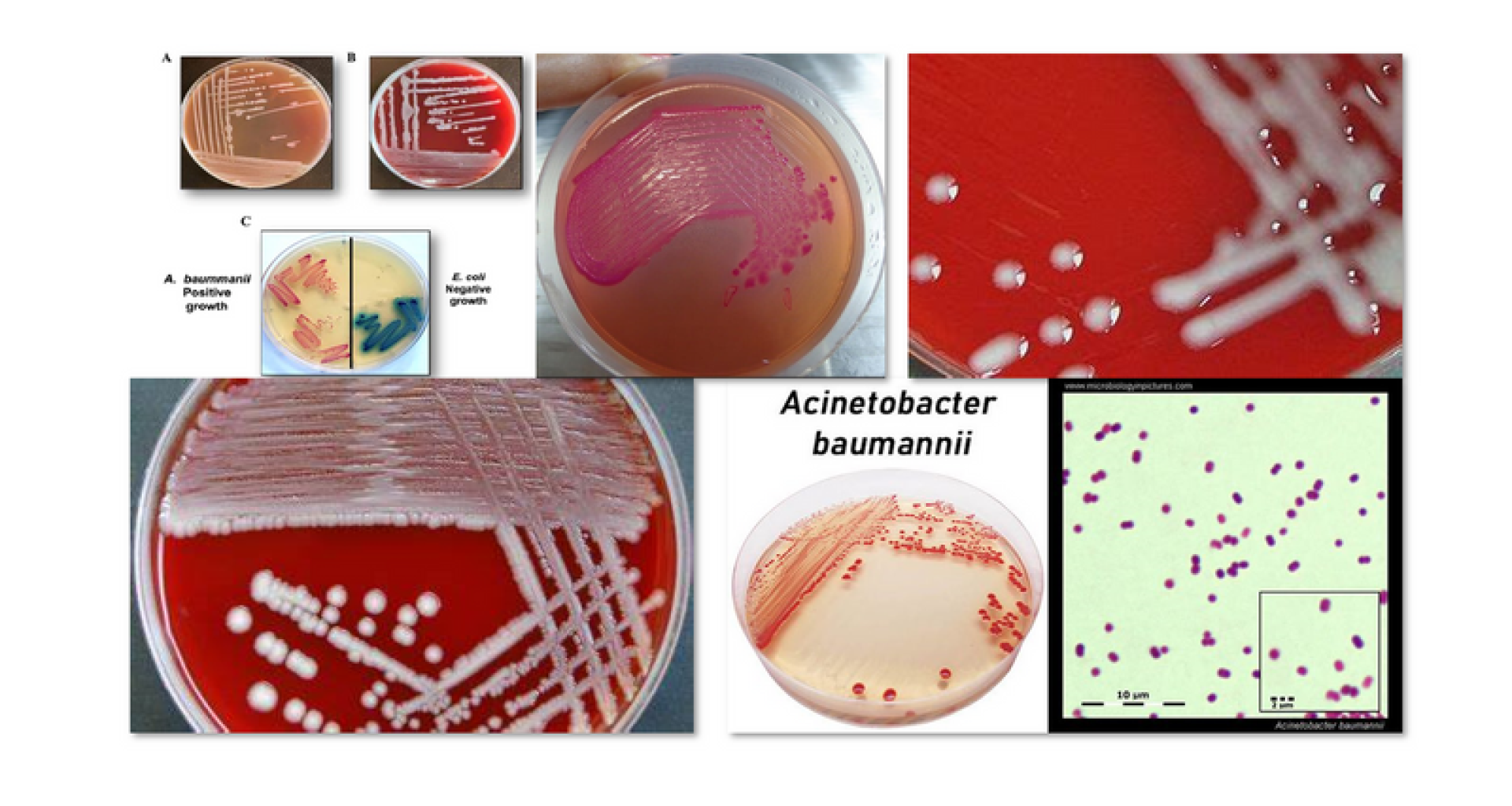 كم تصمد بكتيريا Acinetobacter baumannii في النفايات الطبية؟ 1 كم تصمد بكتيريا Acinetobacter baumannii في النفايات الطبية؟