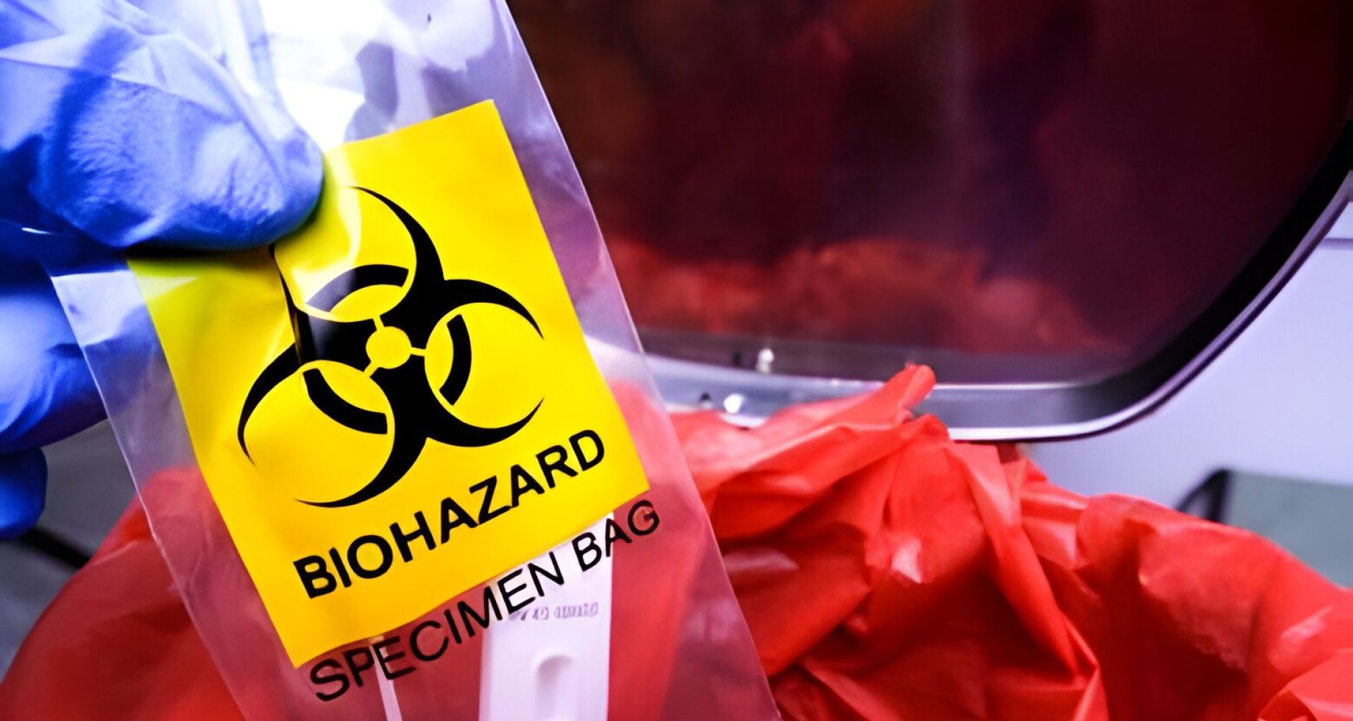 توصيات لتقليل التكلفة في إدارة النفايات الرعاية الصحية 1 توصيات لتقليل التكلفة في إدارة النفايات الرعاية الصحية