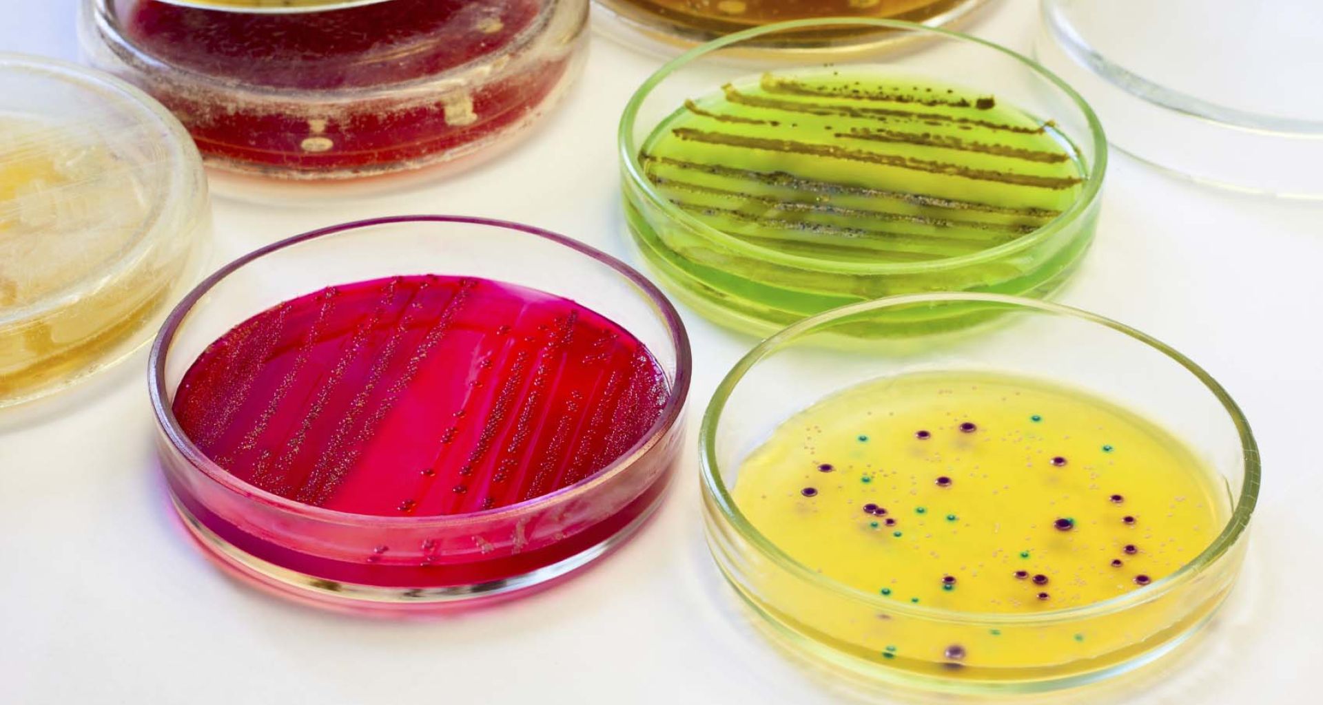 الميكروبات الممرضة والمخلفات الطبية 1 الميكروبات الممرضة والمخلفات الطبية