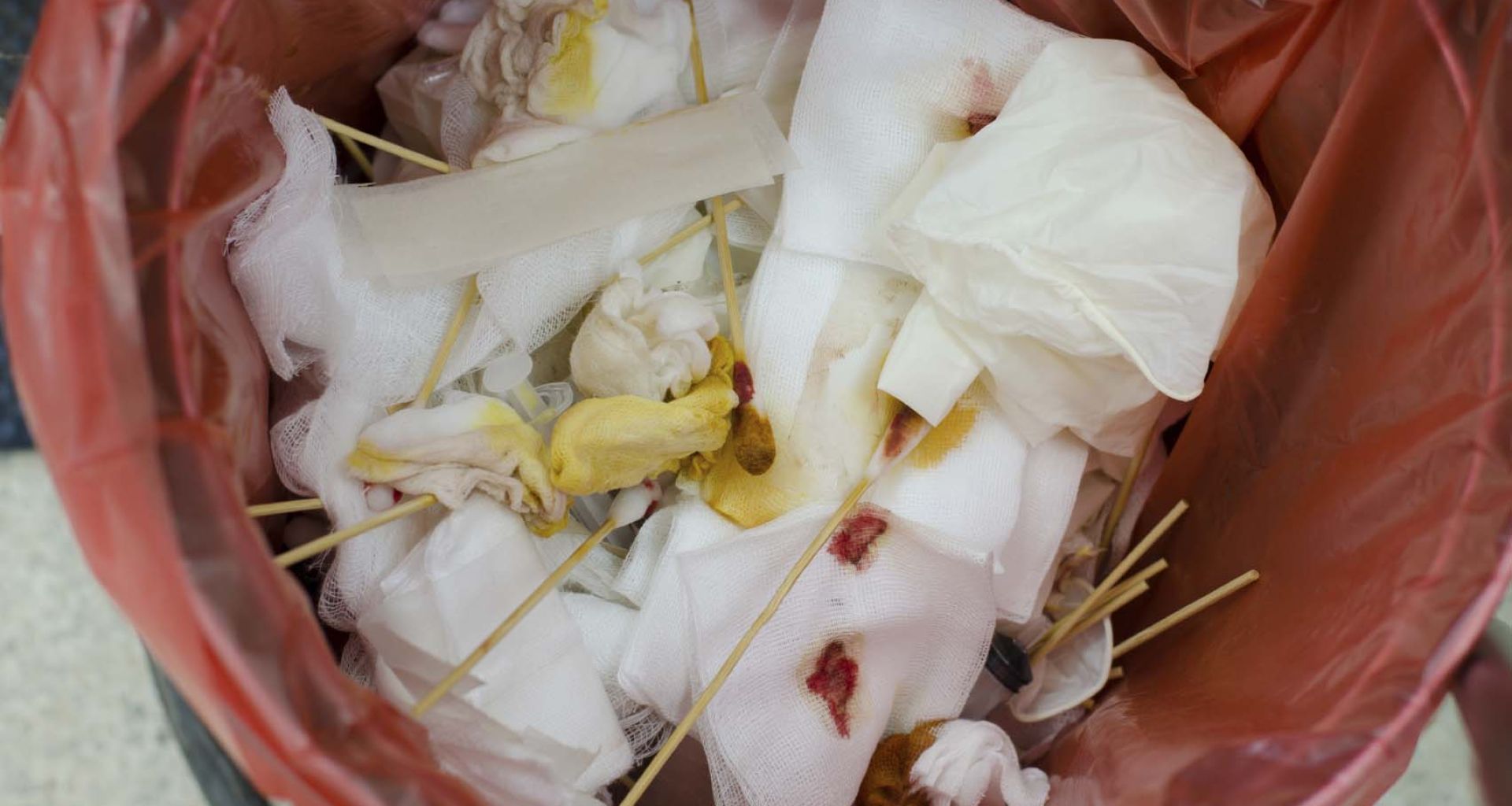 أنواع المخلفات الطبية 1 أنواع المخلفات الطبية