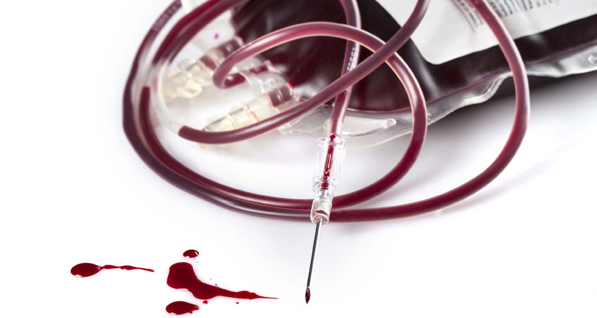 إدارة النفايات من خلال تقليل النفايات 1 إدارة النفايات من خلال تقليل النفايات