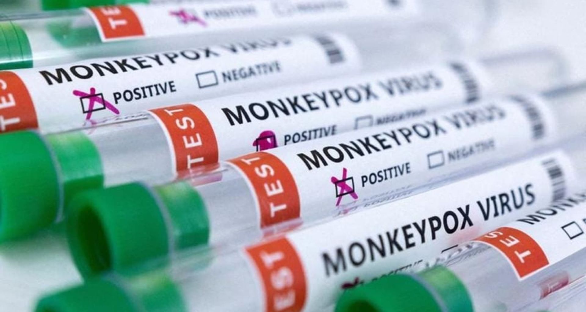 هل الصرف الصحي يعتبر من طرق انتقال فيروس جدري القرود؟ 1 هل الصرف الصحي يعتبر من طرق انتقال فيروس جدري القرود؟