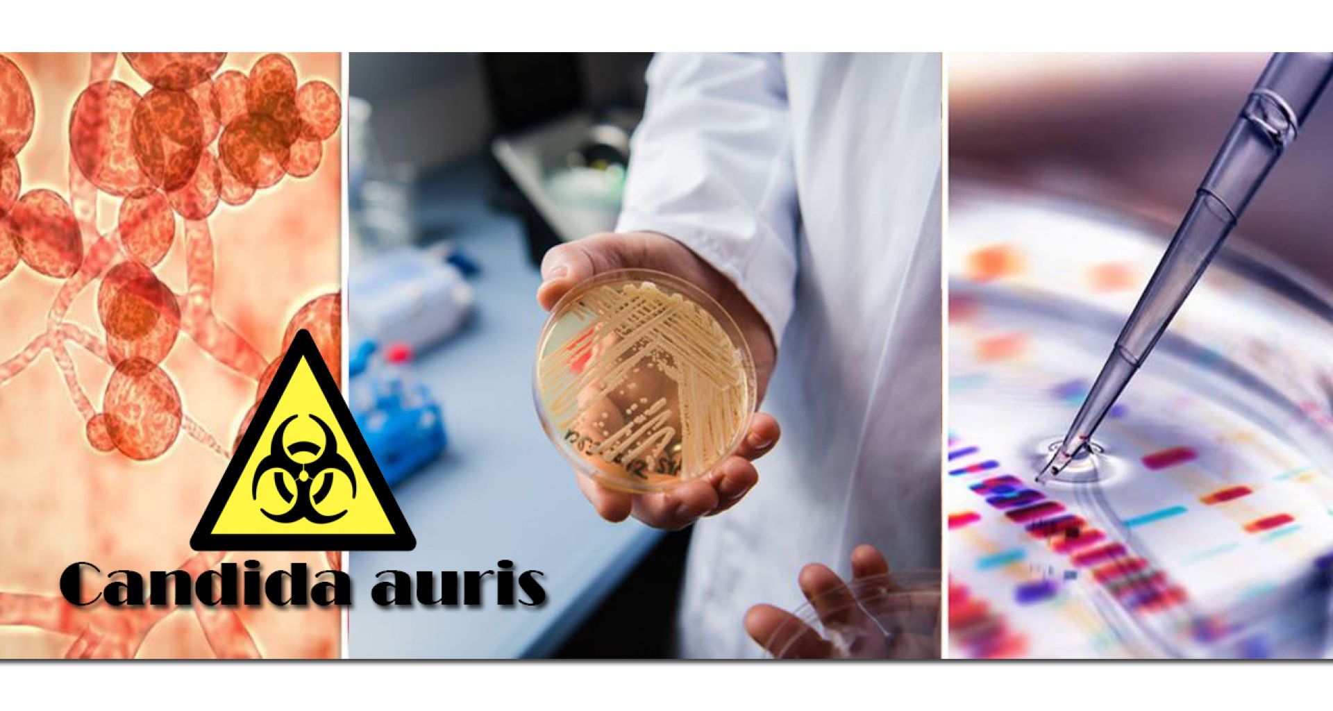 الكنديدا أوريس: جرثومة جديدة مقاومة للأدوية تنتشر في المستشفيات ومرافق الرعاية الصحية في العالم 1 الكنديدا أوريس: جرثومة جديدة مقاومة للأدوية تنتشر في المستشفيات ومرافق الرعاية الصحية في العالم