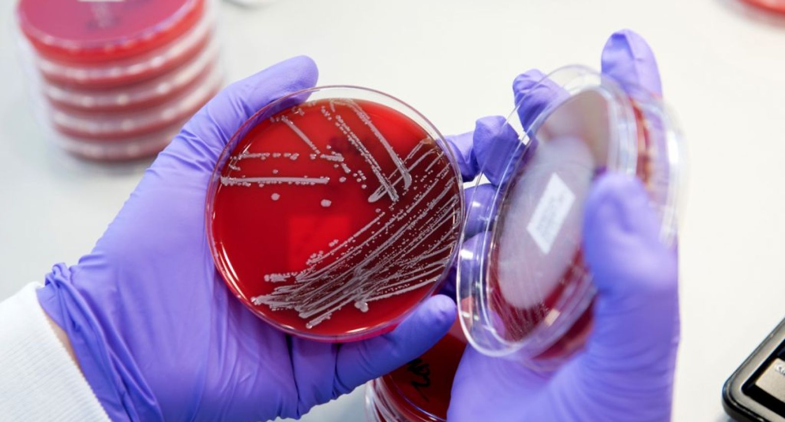 المخلفات الطبية المعدية (أطباق المزارع البكتيرية) 1 الإصابات الجرثومية لعمال نقل النفايات في المكبات العامة