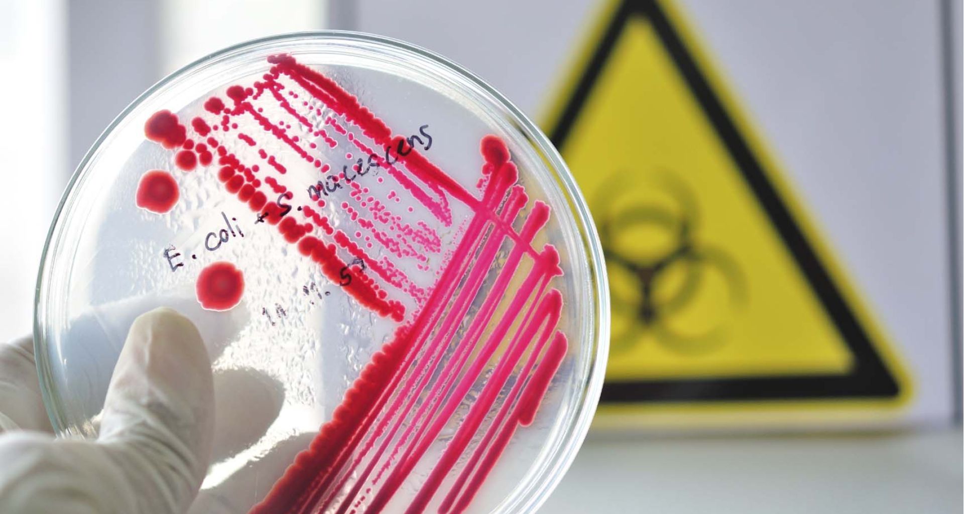 الميكروبات الممرضة: قدرة بقاءها حية في المخلفات الطبية 5 الميكروبات الممرضة: قدرة بقاءها حية في المخلفات الطبية