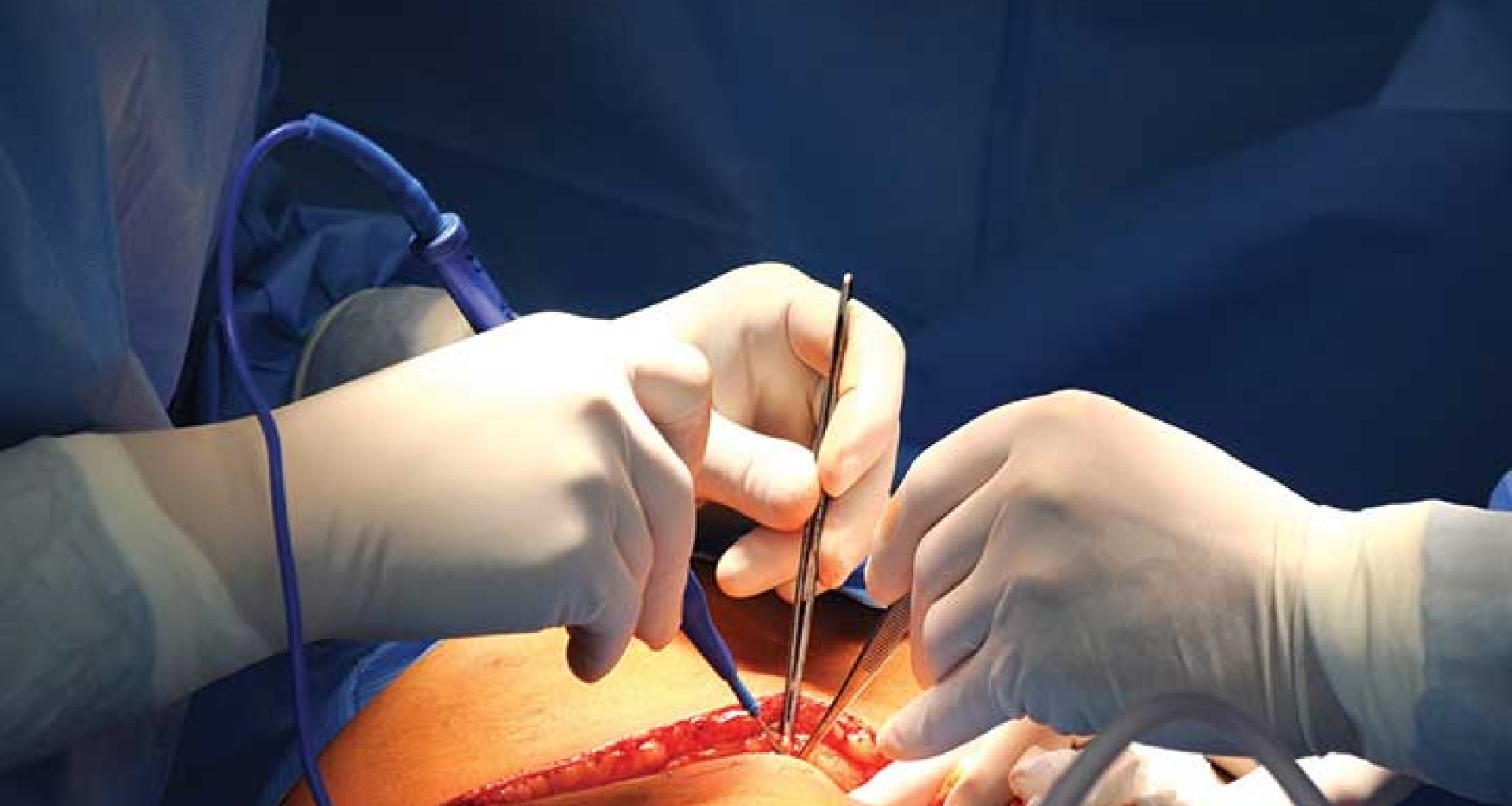 عدوى المستشفيات: أماكن الإصابات بالعدوى (الجزء الثالث) 1 عدوى المستشفيات: أماكن الإصابات بالعدوى (الجزء الثالث)