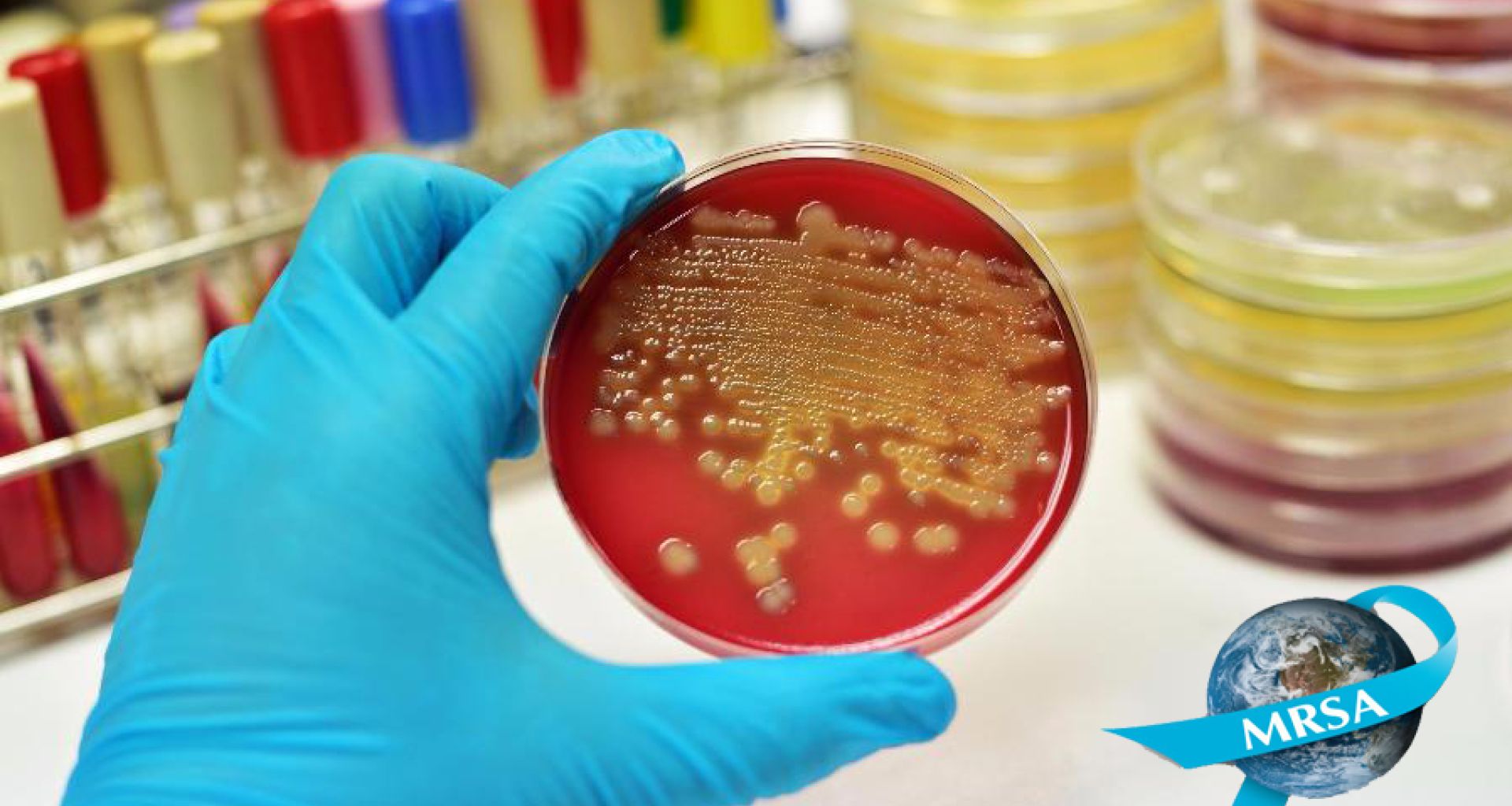 هل هناك داعي للقلق من هذه النتائج...؟ 8 هل هناك داعي للقلق من هذه النتائج…؟