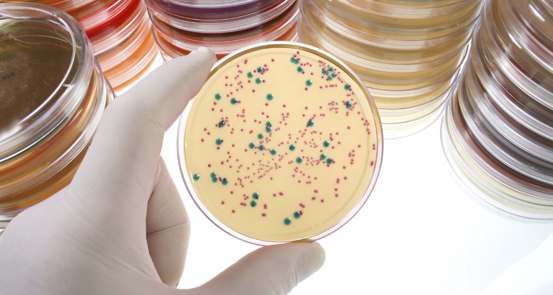 أطباق المزارع البكتيرية في معامل التحاليل الطبية بمدينة طرابلس- ليبيا. 1 أطباق المزارع البكتيرية في معامل التحاليل الطبية بمدينة طرابلس- ليبيا.