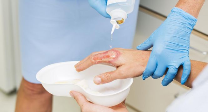 النفايات الطبية بمستشفيات جراحة الحروق والتجميل