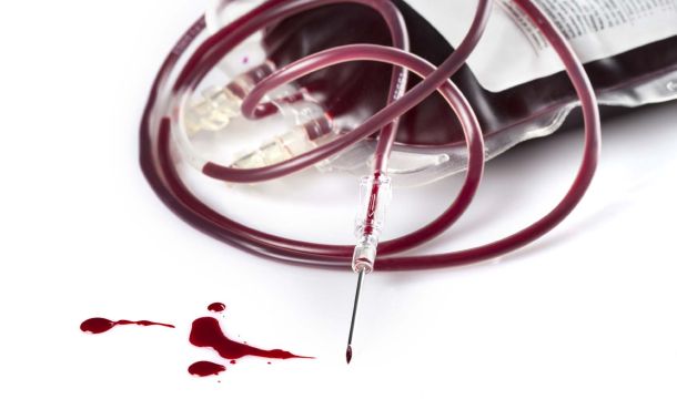 إدارة النفايات من خلال تقليل النفايات