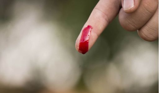 حفرة دفن للنفايات الطبية التشريحية