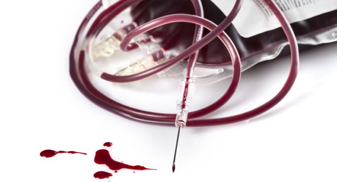 إدارة النفايات من خلال تقليل النفايات
