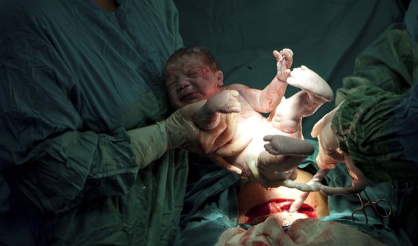 المخلفات الطبية بأقسام الولادة وأمراض النساء
