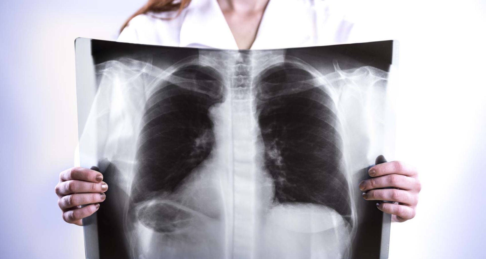 النفايات الطبية الخطيرة: أوراق الأشعة السينية
