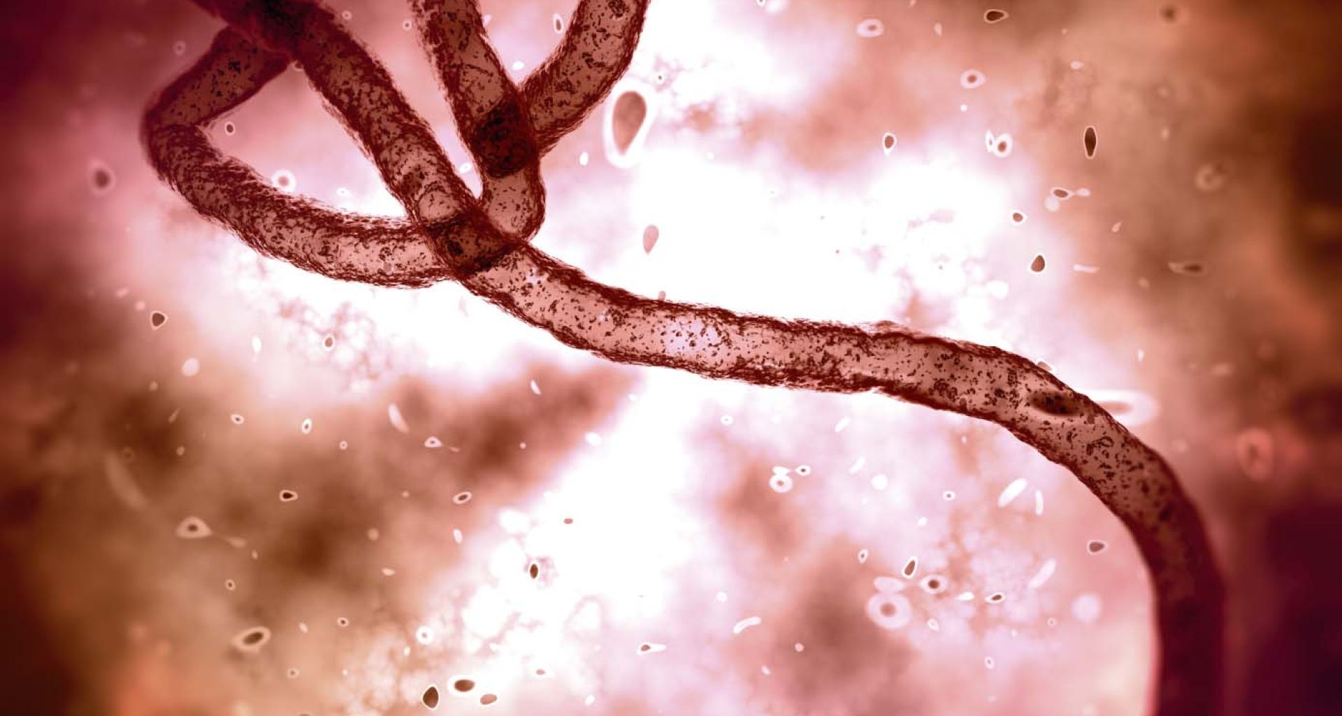مريض فيروس الإيبولا والتخلص من المخلفات الطبية في الولايات المتحدة