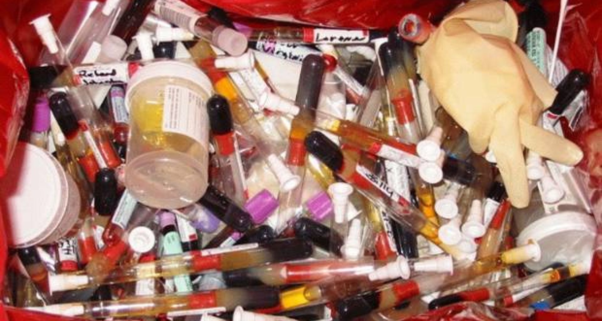 عوامل تساهم في شدة التعرض للميكروبات الممرضة من النفايات الطبية