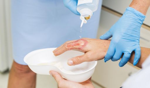 النفايات الطبية ومراكز علاج مرض السل (الدرن)