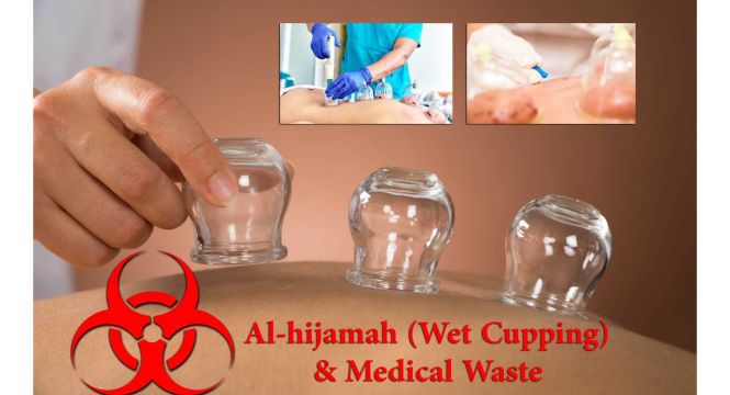 الحجامة الرطبة و مصير نفاياتها الطبية