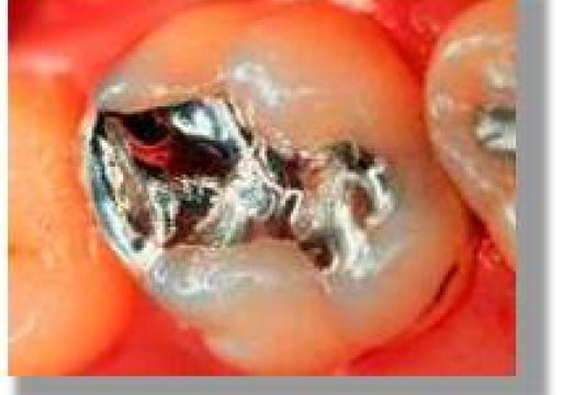 المخلفات الطبية الكيميائية في عيادات الأسنان