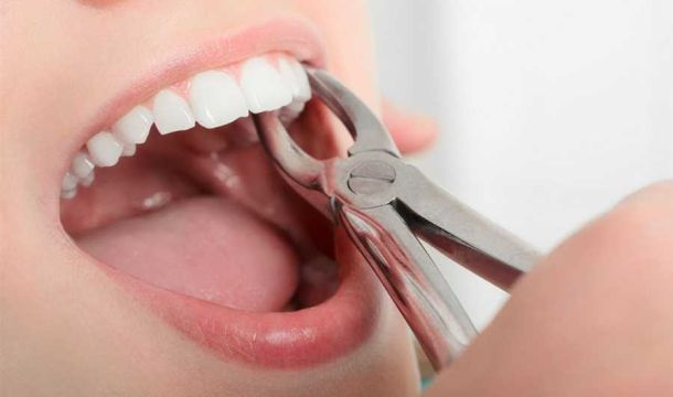 التعامل الآمن مع الأسنان المنزوعة