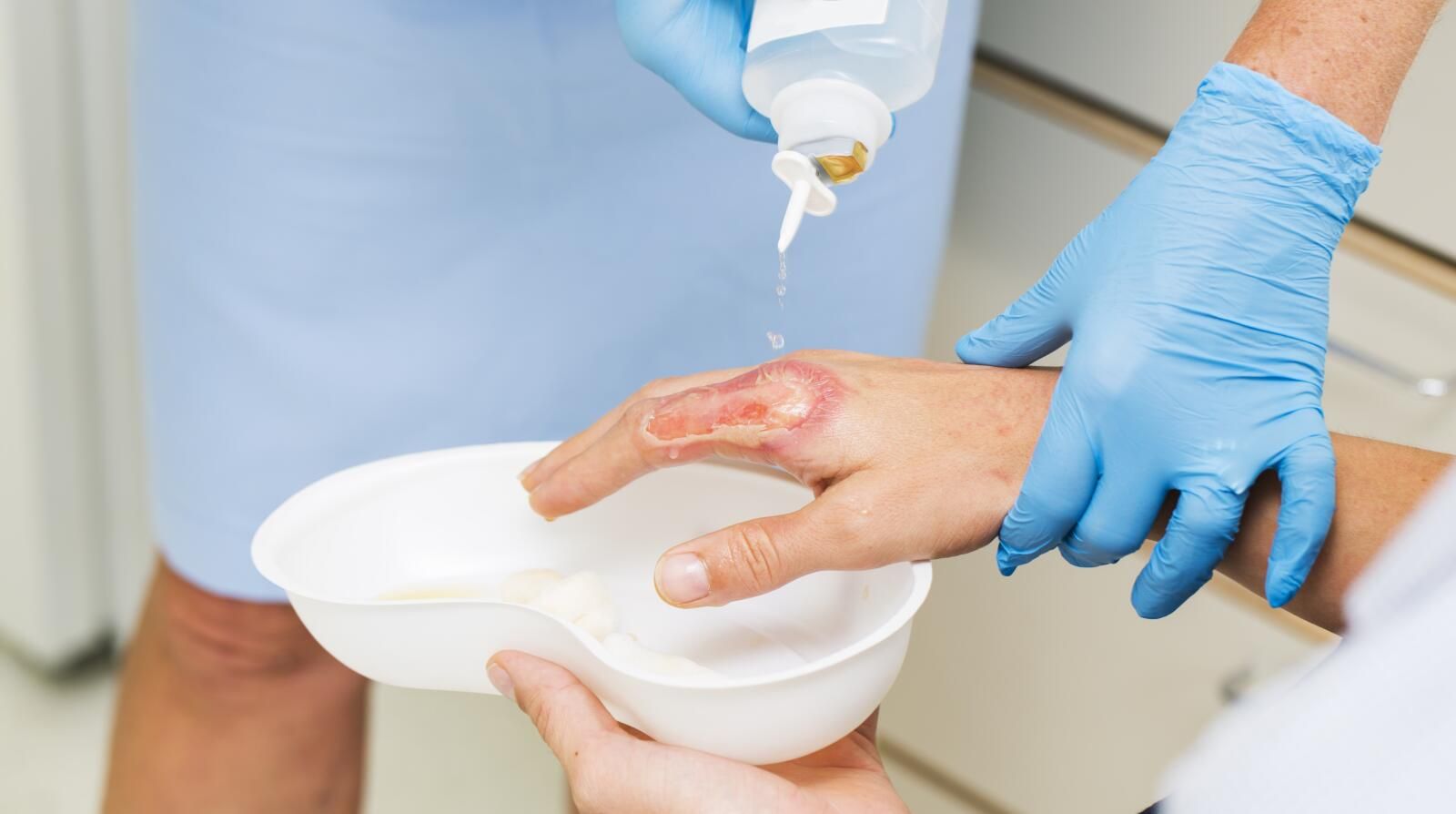 النفايات الطبية بمستشفيات جراحة الحروق والتجميل