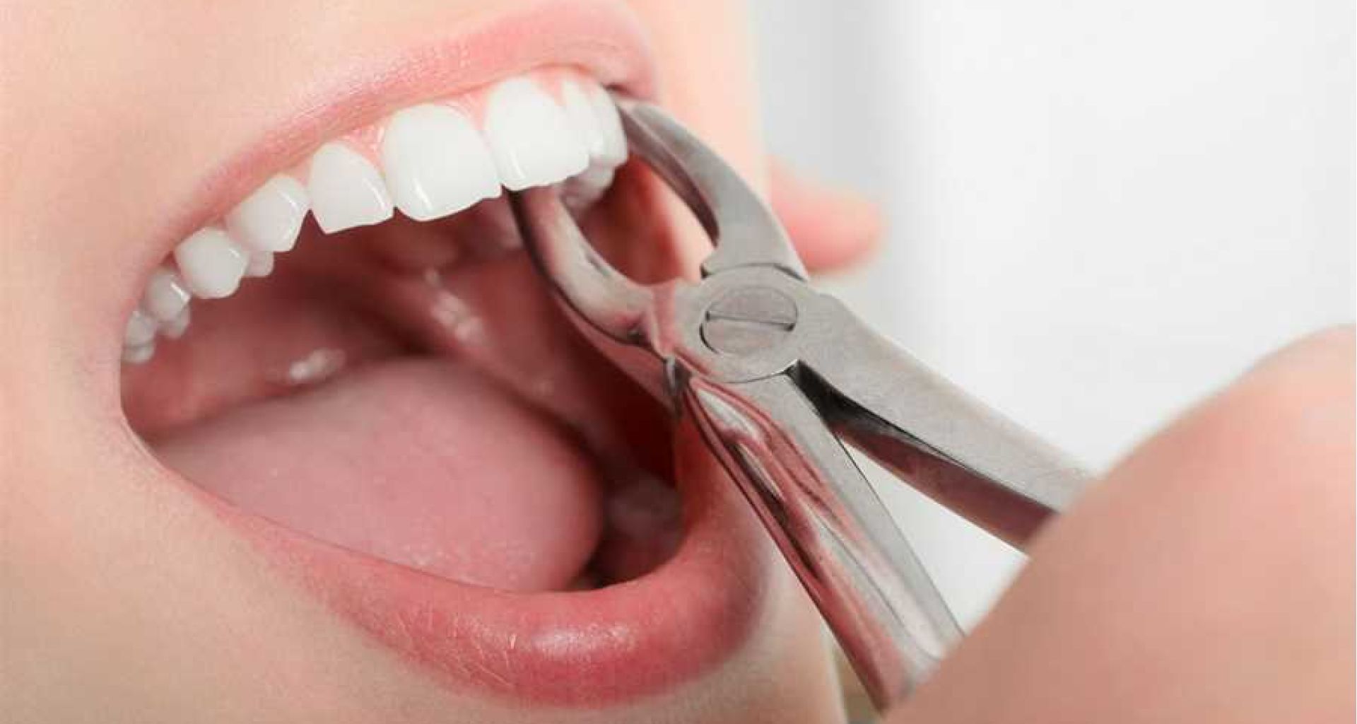 التعامل الآمن مع الأسنان المنزوعة