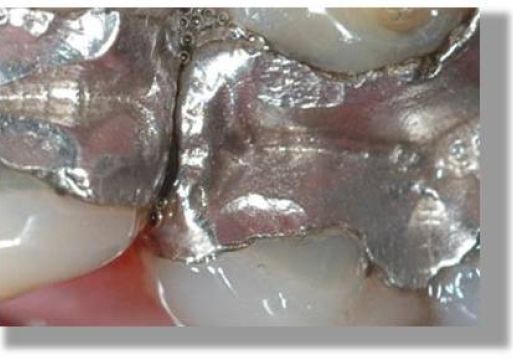 المخلفات الطبية الكيميائية في عيادات الأسنان