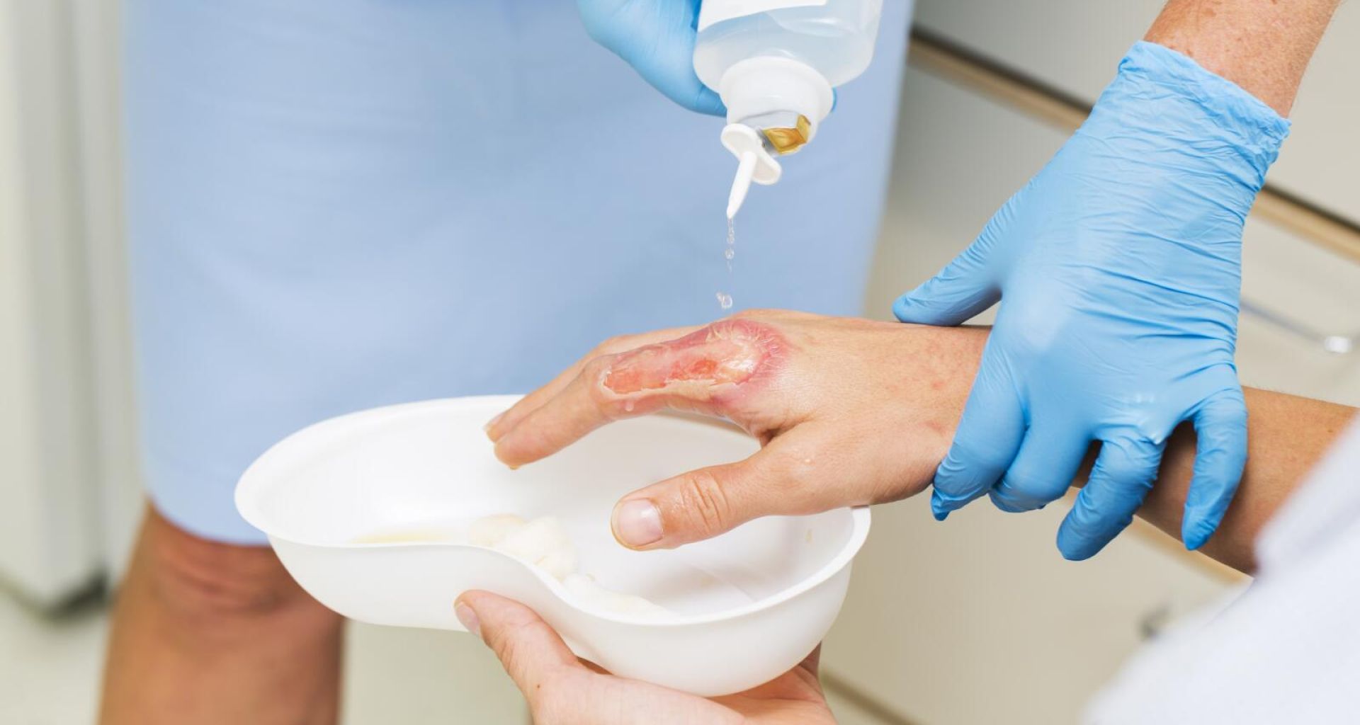 النفايات الطبية بمستشفيات جراحة الحروق والتجميل